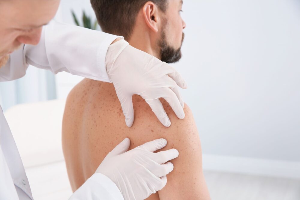 Dermatologist wearing white gloves examining a male patient's back and shoulder for moles or skin abnormalities during a skin check in a medical office.